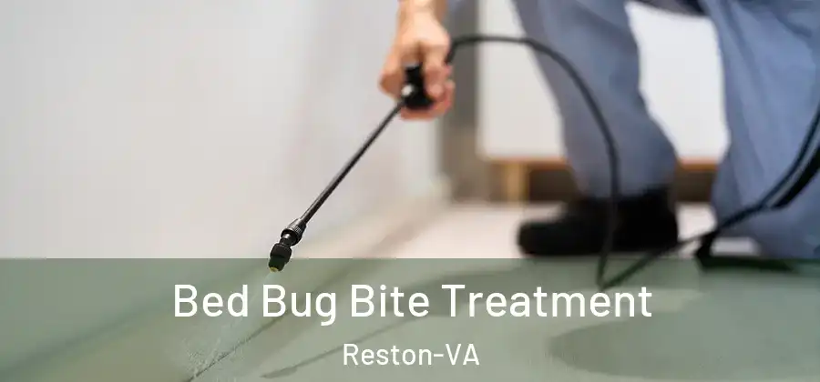 Bed Bug Bite Treatment Reston-VA